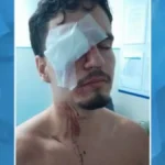 Jovem de 18 anos perde visão após ser atingido por bala de borracha em clássico Flamengo x Vasco