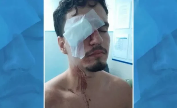 Jovem de 18 anos perde visão após ser atingido por bala de borracha em clássico Flamengo x Vasco